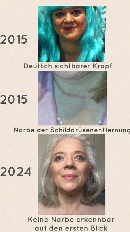Mir_schwillt_der_Hals