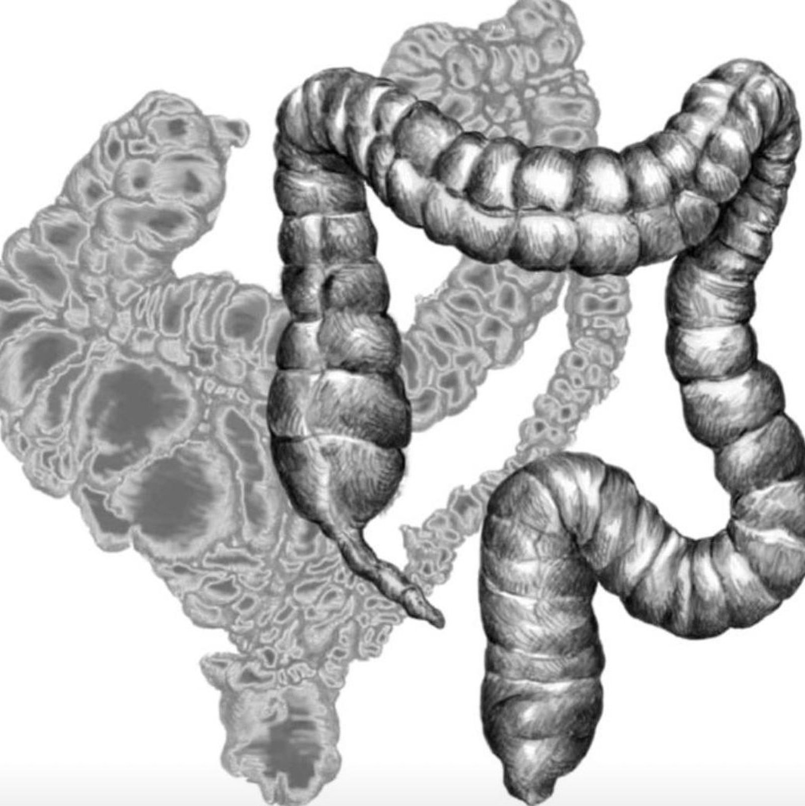 Stress_als_Auslöser_für_Verstopfung__